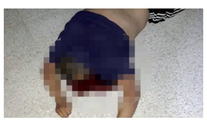 Yardım çağrısı karşılıksız kalan adamın cesedi bulundu