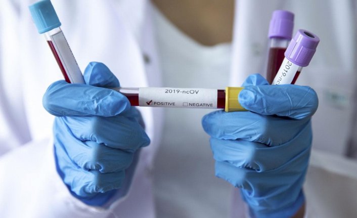 İşte yeni koronavirüs vakası görülmeyen iller...