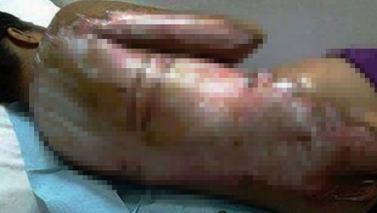 Kahvesini zamanında getirmedi diye...