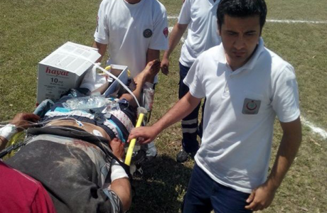 Kuzeninin bacağını kopardı