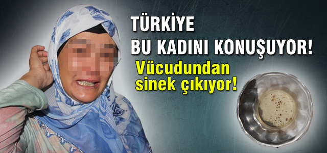Vücudundan sinek çıkan kadın görenleri hayrete düşürdü!