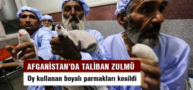 Oy kullanan boyalı parmakları kesildi
