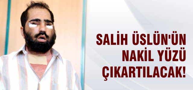 Salih Üslün'ün nakil yüzü çıkartılacak
