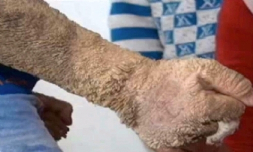 Kertenkele çocuğun feryadı