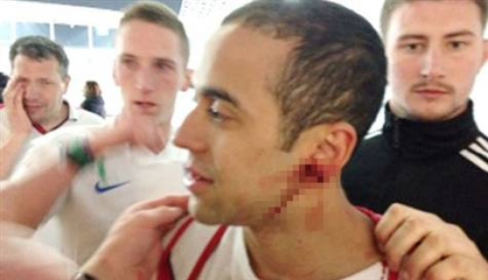 Suarez'i izlerken kulağından ısırıldı