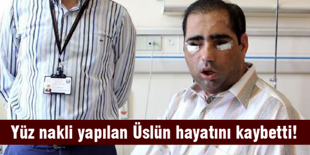Yüz naklinde kötü son