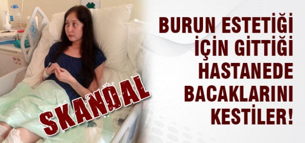 Burun estetiği oldu bacakları kesildi!