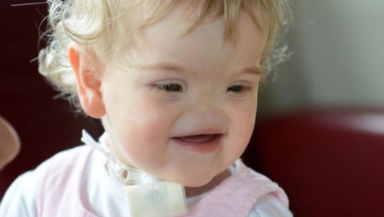 Minik Tessa'nın büyük mücadelesi!