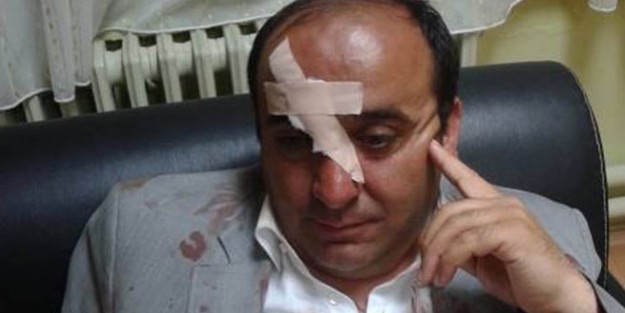 Belediye Başkanı'na saldırı!