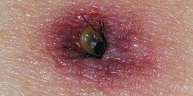 Keneye bir kurban daha!