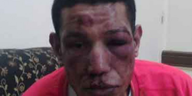 Ramazan'da sokakta yemek yiyen adamın dudaklarını yaktılar