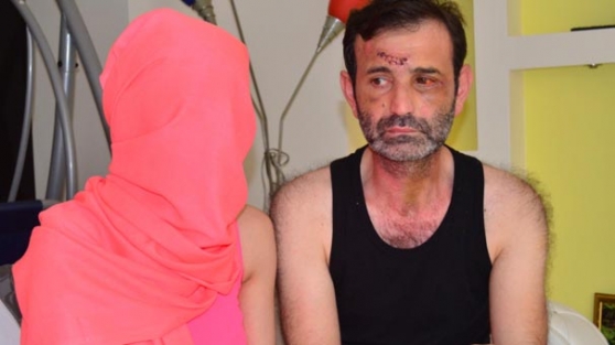 Kız arkadaşıyla sopayla dayak yediler