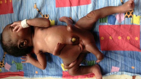 Ahtapot bebek görenleri şaşırtıyor