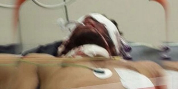 IŞİD üyesi Türkiye'de mi tedavi ediliyor?