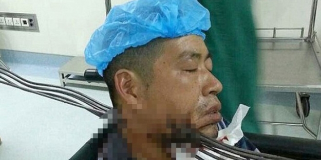 Boğazına altı demir saplandı hayatta kaldı!