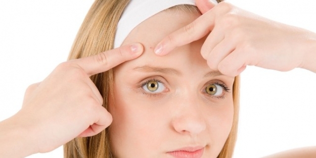 Sivilice Ve Aknelere Yoğurt İle Savaş Açın