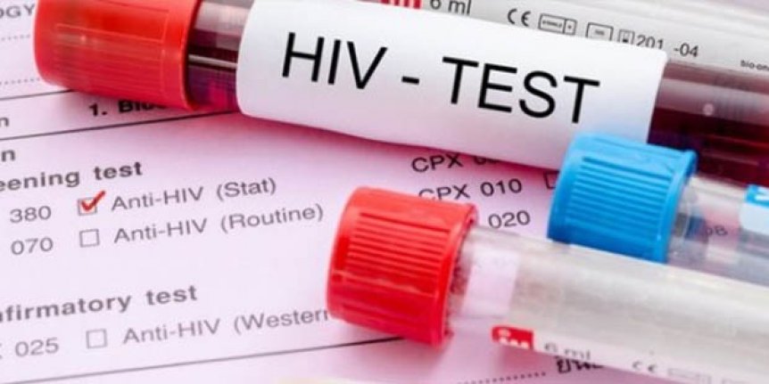 Türkiye’de HIV görülme yaşı 15’e kadar düştü