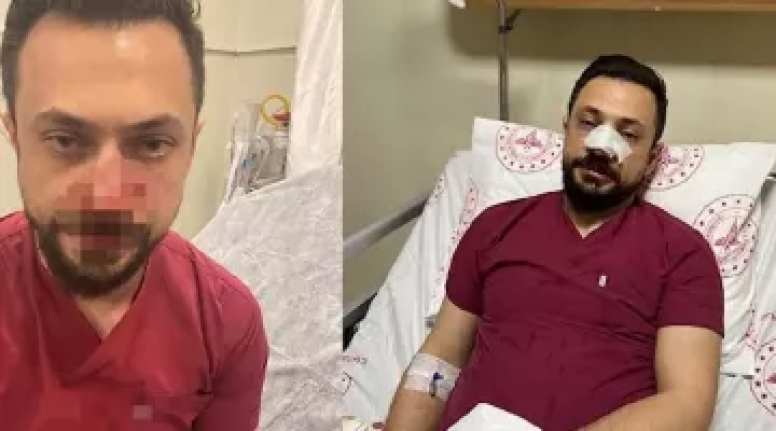Sağlıkta şiddet devam ediyor: Hasta yakını doktorun burnunu kırdı