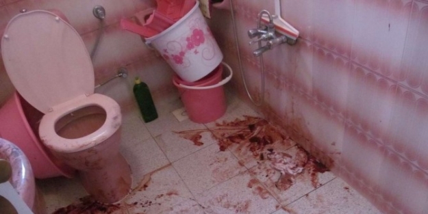 Para Vermediği Eski Komşusu Tarafından Boğazı Kesildi