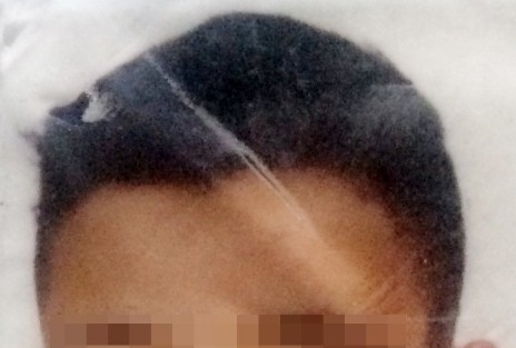 Uyuşturucu Alan Genç Bileklerini Kesti